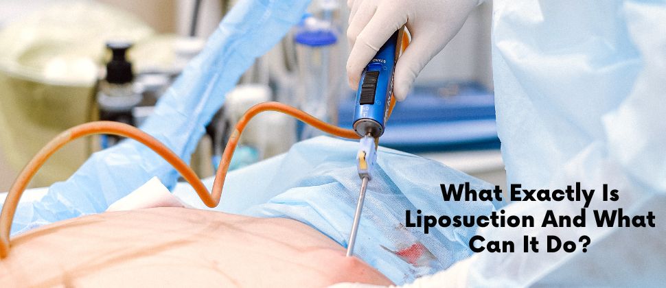 What Exactly Is Liposuction